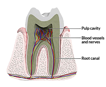 Root Canal Therapy - Canton Dental